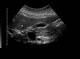 1m av  Catherine Olsson, sonograf